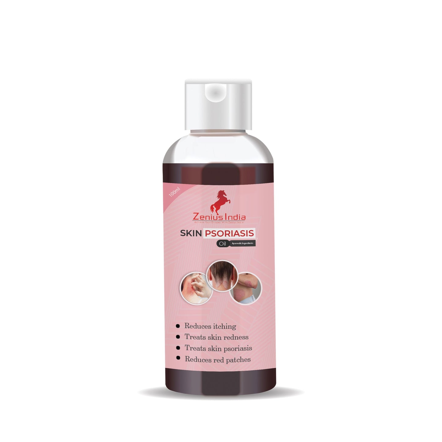Zenius Skin Psoriasis Oil for Controlling Skin Itching, Redness, Scaling & Discomfort 100ML Oil